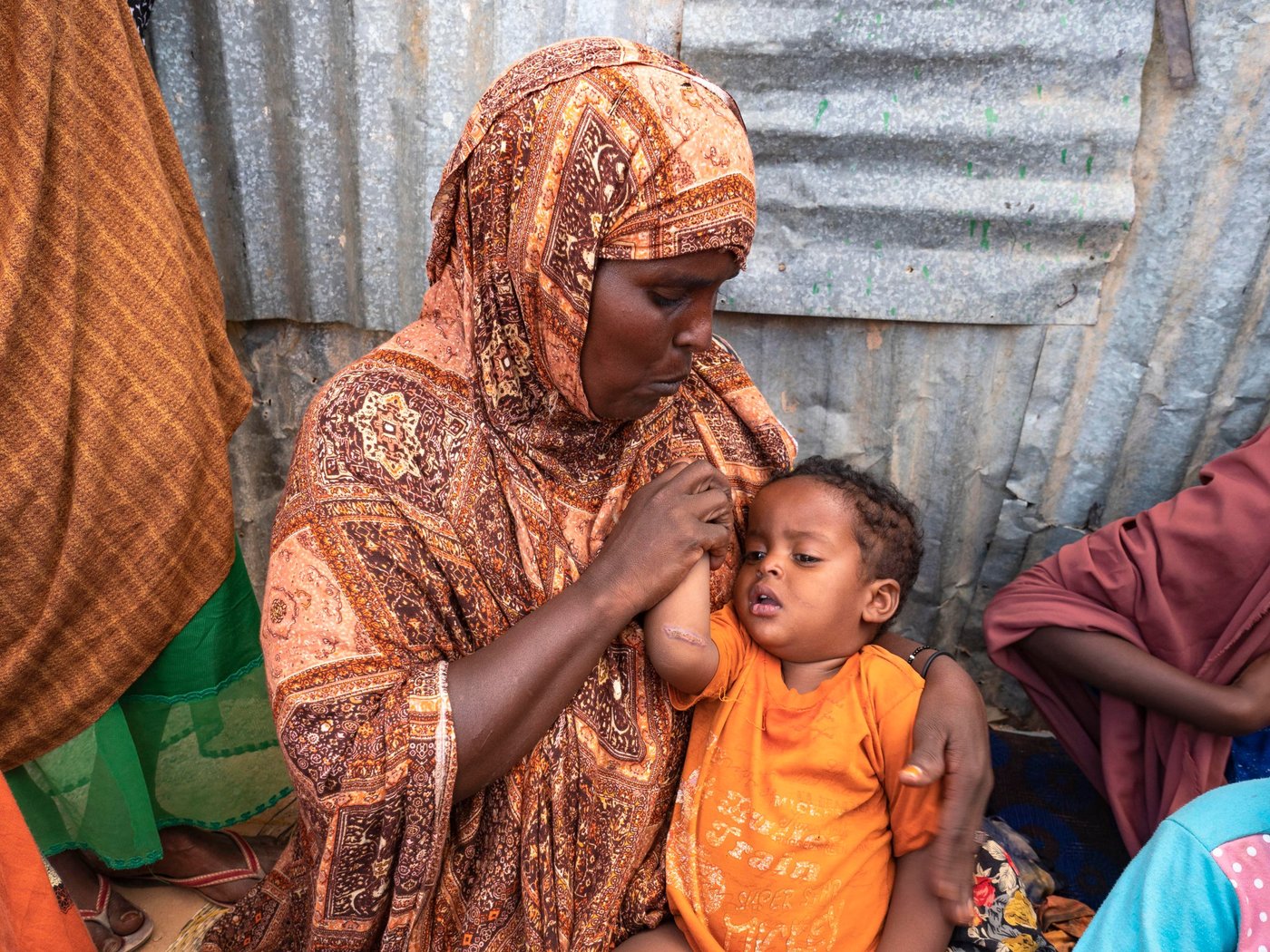 Farhiyo shows the nasty cut that her 18-month-old son Yasin has on his arm. A man entered their hut recently and attacked her with a knife. Photo: Ingrid Prestetun/NRC