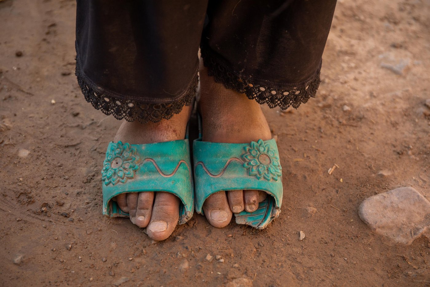 This is becoming the third winter that the drought displaced households live in a displaced camp with limited job and livelihood opportunities. However, as the Covid-19 pandemic and gathering restrictions were imposed during the summer, the local economies were impacted and the most vulnerable households fell into deeper poverty. During the pandemic, vulnerable, female-headed households were exposed many risks due to their economic situation. The pandemic came at a time when the country was dealing with a deadly conflict and an election dispute that split the government, and a dire economy that put half of the population below the poverty line.
Fatima, 13, and her family were displaced from Badghis province two and half years ago. They live in Shaidayee displaced site. Fatima’s father was killed in Badghis and the family do not have anyone to support them. The live in a makeshift home and last winter the roof of their home collapsed on them due to heavy rainfalls.
Fatima’s family and thousands more rely on humanitarian assistance and they have not received any support in the past six months. In March, NRC, with support from ECHO, distributed hygiene and sanitation packages for the families, including Fatima’s family to protect them against the Covid-19 pandemic.
“During the distribution we had nothing at our home. When we received the package that was included soaps, shampoos, toothpaste and washing soaps, I kept some for the family and sold the rest and bought a small bottle of cooking oil and wheat flour,” said Fatima’s mother. “The winter is approaching and we do not have food to eat. I always worry about my children and I may lose them due to hunger and cold this winter.”
Fatima’s brother worked on the poppy field and southern parts of the country like, Hilmand, Uruzgan and Kandahar to support the family. But he has been addicted to opium himself and does not visit the family or support them financially.
Photo: Enayatullah Azad / NRC